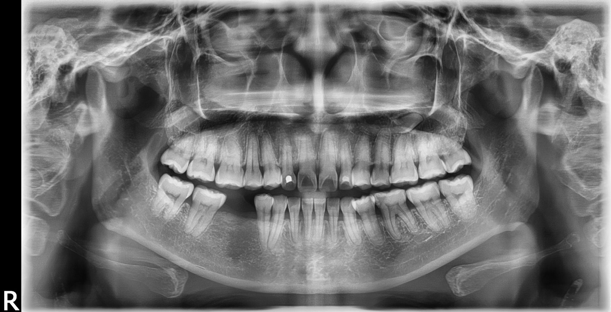 Dental Exam & X-Ray